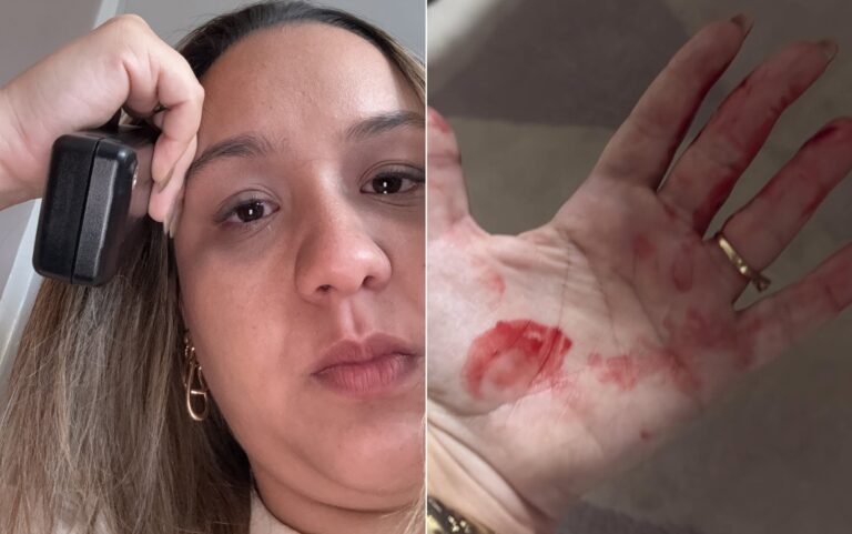 Advogada que denuncia agressão do ex-companheiro desabafa sobre medo seis meses após violência e cobra punição: ‘Fiz tudo e nada mudou’
